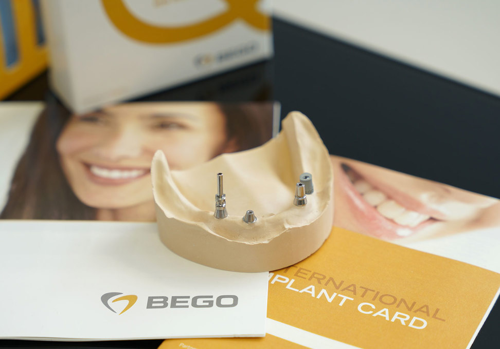 30% popusta na implantate!